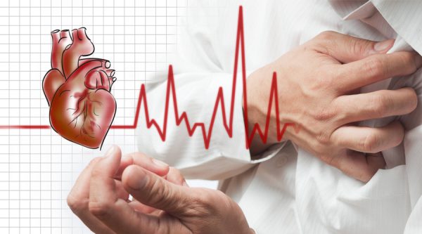 К развитию экстрасистолии может привести ишемическая болезнь сердца