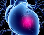 Как лечить стенокардию сердца