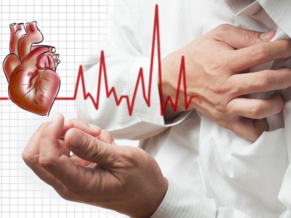 Разновидности ишемической болезни сердца