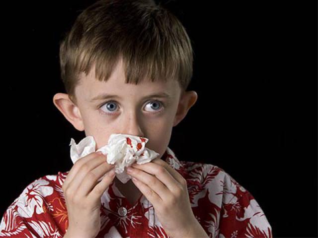 Кровотечение из носа у детей не редкость