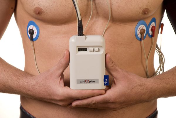 Устройство для мобильного мониторинга сердечного ритма